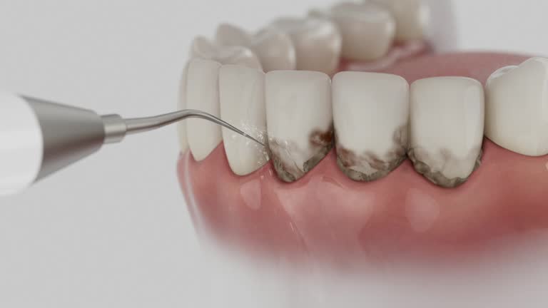 Reliable Teeth Cleaning And Checkup contractor in Macon County County, GA by Dentist Open Now